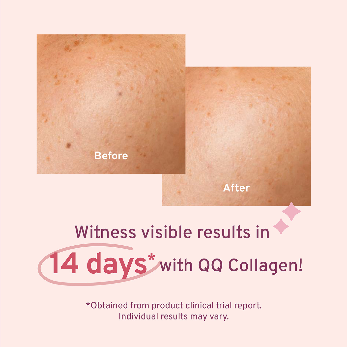 QQ Collagen before & after results